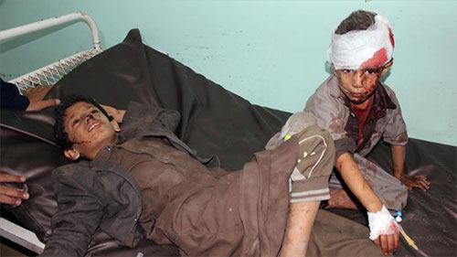 niños yemeníes heridos en un ataque saudí